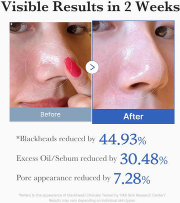 Medicube Dual-Textured Facial Toner Pads